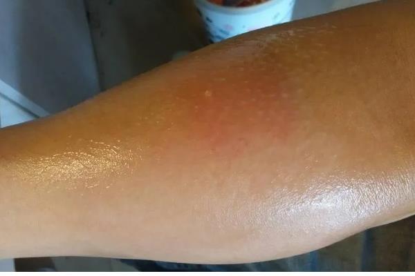 饲养肉鸭怎么搭配饲料，一般用玉米、菜饼、麸皮等材料去配制